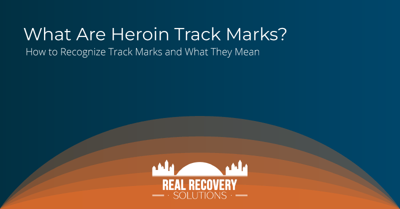 Heroin Track Marks 4 Heroin Track Marks